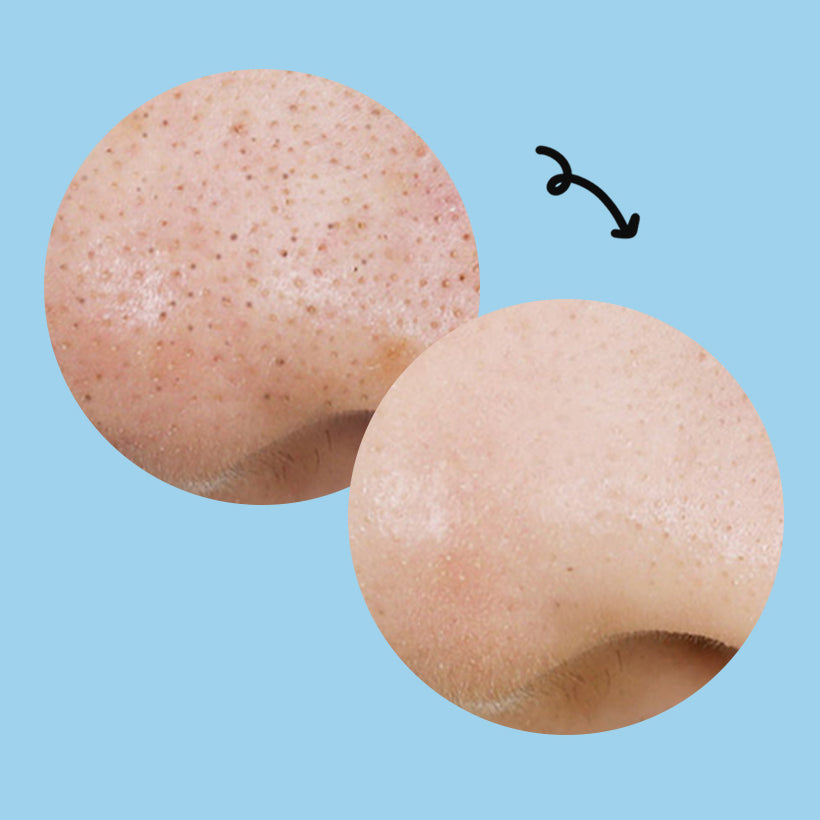 [ma:nyo] Blackhead Pure Cleansing Oil Kill Pad 50 Pads